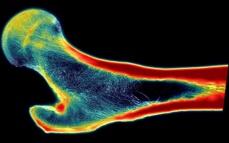 Imagen: La microestructura de este fémur es claramente visible como resultado de la tecnología de súper resolución de SwRI (foto cortesía de SwRI)