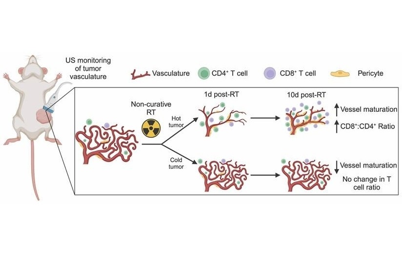 Imagen: La detección por ultrasonido de cambios vasculares posteriores a la RT corresponde a cambios en el microambiente inmunológico (Foto cortesía de Theranostics, DOI:10.7150/thno.97759)