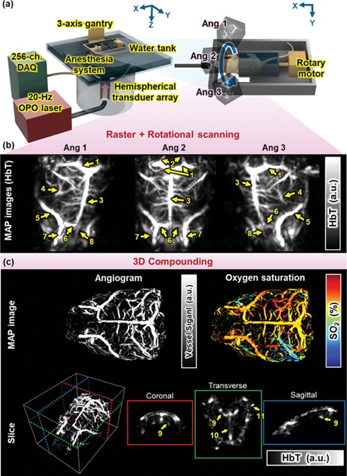 Imagen: Sistema PACT de cerebro completo e imágenes morfológicas in vivo (foto cortesía de Advanced Science)