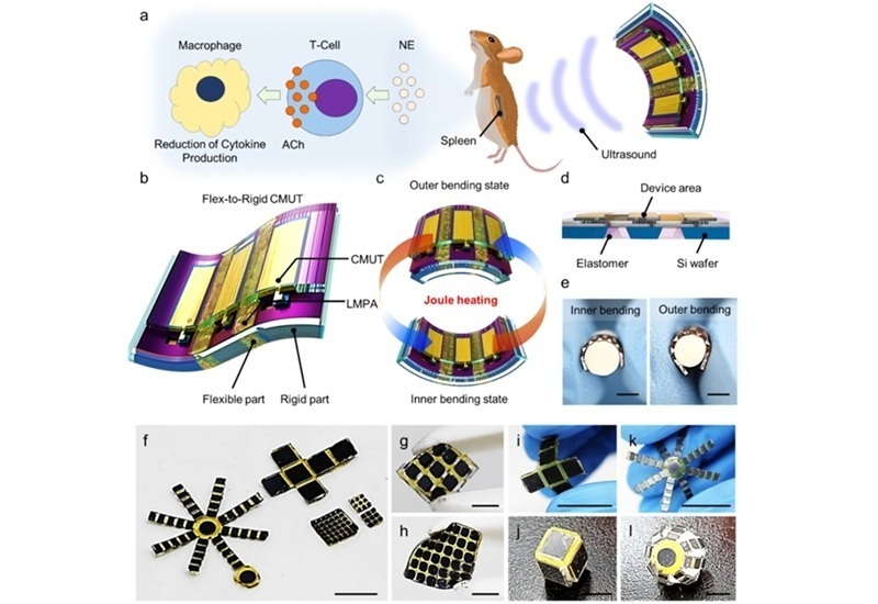 Imagen: el sensor de ultrasonido flexible y adaptable para dispositivos portátiles mantiene una alta potencia acústica para la obtención de imágenes y el tratamiento (Lee, SM., Liang, X., Jo, Y. et al. npj Flex Electron 9, 107 (2025). DOI: 10.1038/s41528-025-00484-7) Imagen: el sensor de ultrasonido flexible y adaptable para dispositivos portátiles mantiene una alta potencia acústica para la obtención de imágenes y el tratamiento (Lee, SM., Liang, X., Jo, Y. et al. npj Flex Electron 9, 107 (2025). DOI: 10.1038/s41528-025-00484-7)