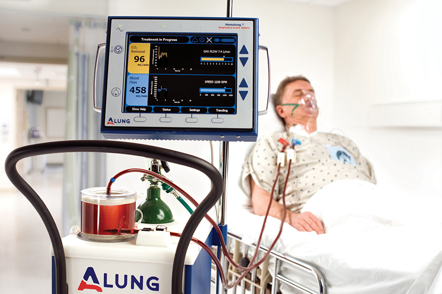 The Hemolung Respiratory Assist System (RAS)