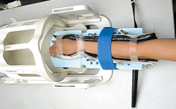 Image: The forearm of a healthy volunteer in the wrist harness (Photo courtesy of Plos One). Image: The forearm of a healthy volunteer in the wrist harness (Photo courtesy of Plos One).