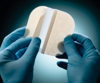 Image: The BeneHold range of absorbent wound dressings (Photo courtesy of Vancive Medical Technologies).