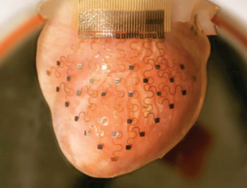 Image: 3-D printed membrane with embedded sensors on a rabbit’s heart (Photo courtesy of WUSTL).