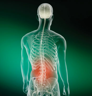 Image: A patient receiving burst neurostimulation with the Prodigy Chronic Pain System (Photo courtesy of St. Jude Medical). Image: A patient receiving burst neurostimulation with the Prodigy Chronic Pain System (Photo courtesy of St. Jude Medical).