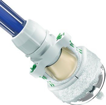 Image: The Edwards Intuity Elite valve system and rapid deployment system (Photo courtesy of Edwards Lifesciences). Image: The Edwards Intuity Elite valve system and rapid deployment system (Photo courtesy of Edwards Lifesciences).