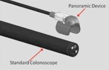 Image: The Third Eye panoramic Device (Photo courtesy Avantis Medical Systems).