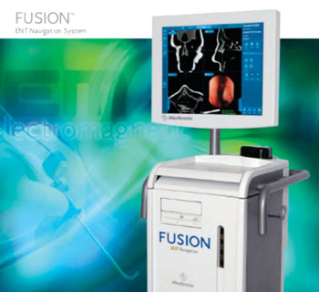 Image: The Medtronic Fusion ENT Navigation System (Photo courtesy of Medtronic).
