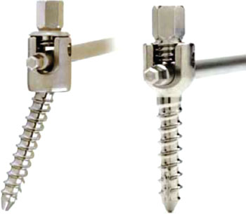 Image: SHILLA multi-axial screw (left) and fixed angle screw (right) (Photo courtesy of Medtronic).