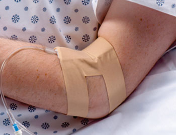 Image: The Dale IV-ARMOR protective overlay (Credit: Courtesy Dale Medical Products).