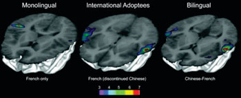 Image: Finding lost languages in the brain (Photo courtesy of McGill University).