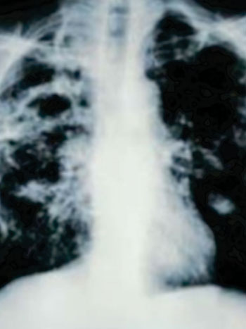 Image: An image from a CT scan (Photo courtesy of Consumer Reports). Image: An image from a CT scan (Photo courtesy of Consumer Reports).