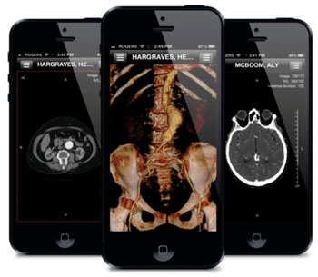 Image: ResolutionMD across multiple devices (Photo courtesy of Calgary Scientific).