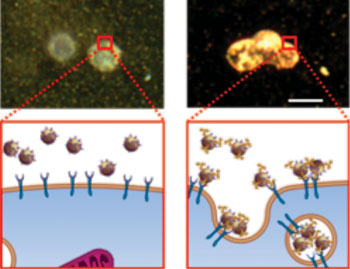 Image: Imaging technique for detecting micrometastases (Photo courtesy of Newswise).
