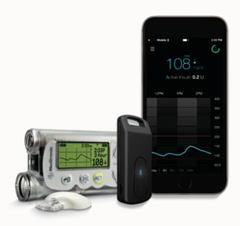 Image: The Medtronic Connect device (Photo courtesy oof Medtronic).