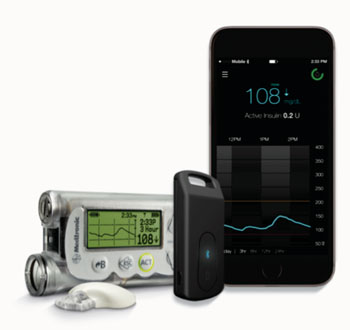 Image: The Medtronic Connect device (Photo courtesy of Medtronic).