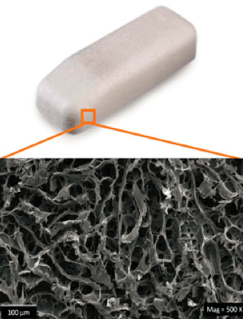 Image: Structure of the dissolvable NasaStent (Photo courtesy of Smith & Nephew).