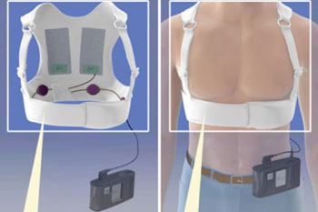 Image: The LifeVest defibrillator (Photo courtesy of ZOLL).