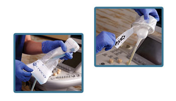 Image: The image depicts a new generation of sterile barriers from CIVCO Medical Solutions (Photo courtesy of CIVCO Medical Solutions).