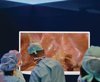 Image: The Olympus VISERA 4K 55-inch primary operative display (Photo courtesy of Sony Olympus Medical Solutions).