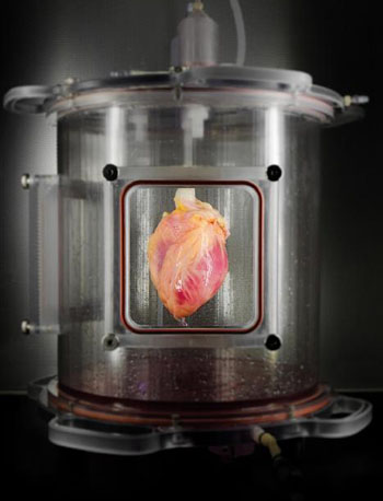 Image: A partially recellularized human whole-heart cardiac scaffold cultured in a bioreactor (Photo courtesy of MGH Center for Regenerative Medicine). Image: A partially recellularized human whole-heart cardiac scaffold cultured in a bioreactor (Photo courtesy of MGH Center for Regenerative Medicine).