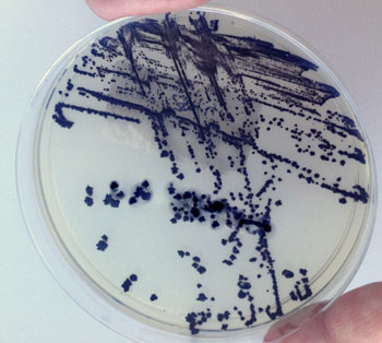 Image: Clostridium difficile in a Petri dish (Photo courtesy of the University of Portsmouth).