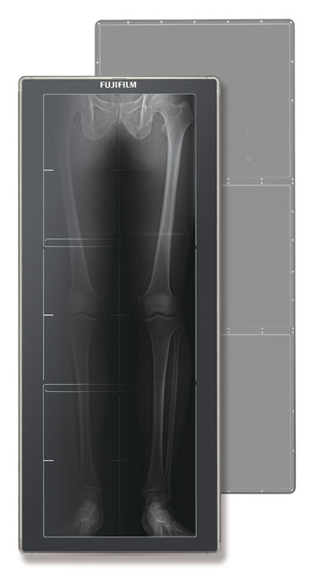 Image: The FDR D-EVO GL system, the world’s first long-length DR detector (Photo courtesy of FUJIFILM).