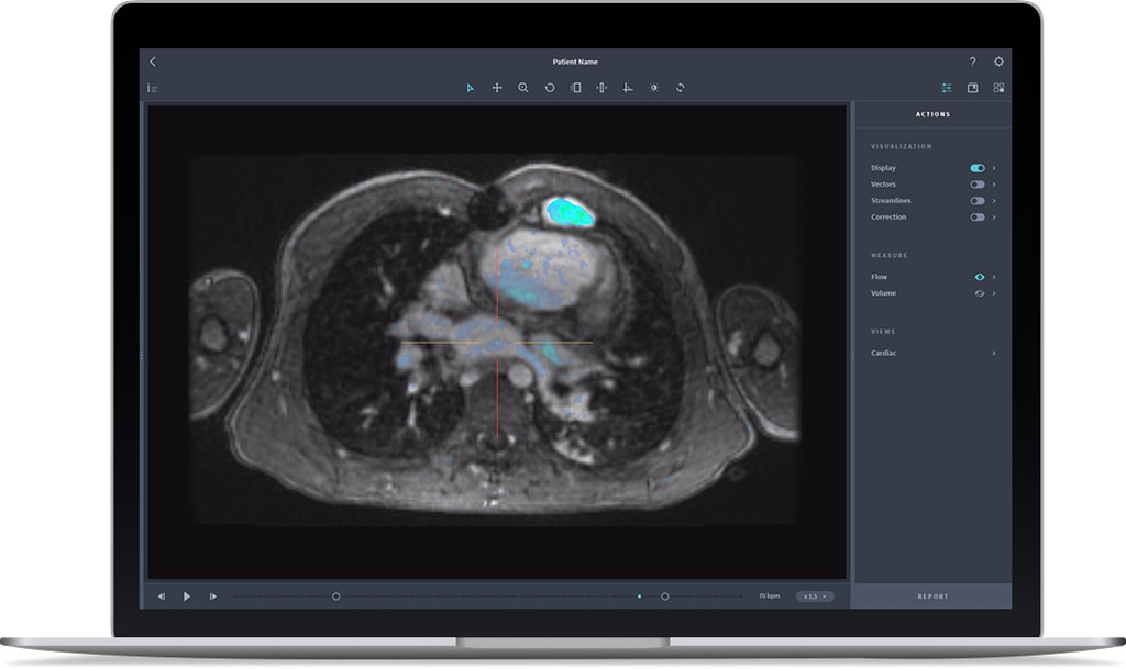 Image: The ViosWorks uses MRI scans to analyze heart function (Photo courtesy of Arterys). Image: The ViosWorks uses MRI scans to analyze heart function (Photo courtesy of Arterys).