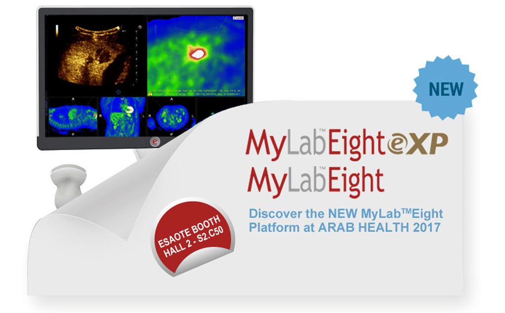 Image: Esaote presented the MyLab Eight ultrasound platform, along with MyLab One, portable ultrasound with touch, at Arab Health (Photo courtesy of Esaote).