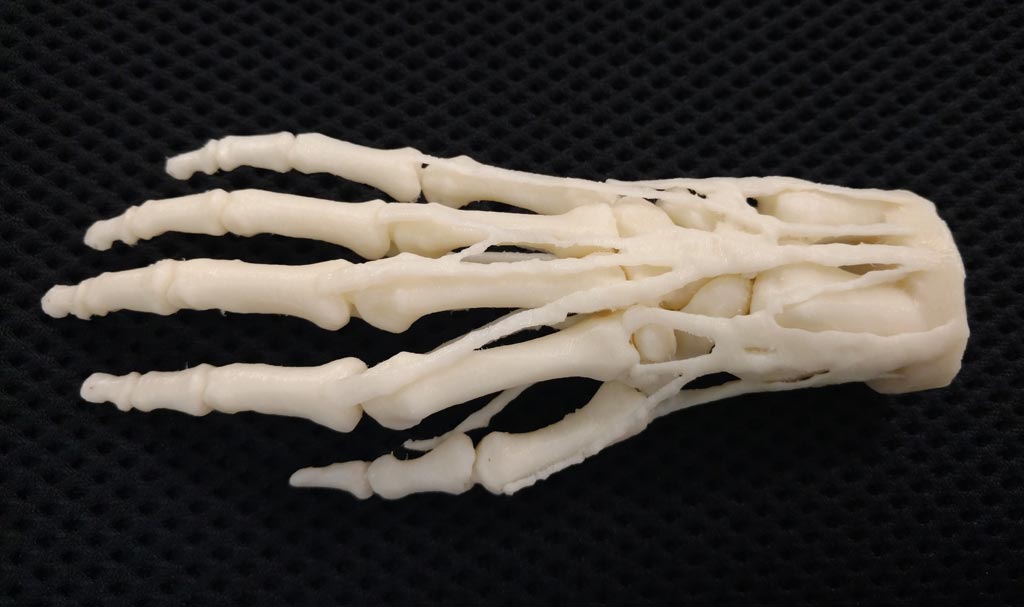 Image: A 3D-printed hand model for teaching, diagnosis, and procedure planning. VA hospitals can request models 3D printed on network printers for shipment (Photo courtesy of Stratasys).