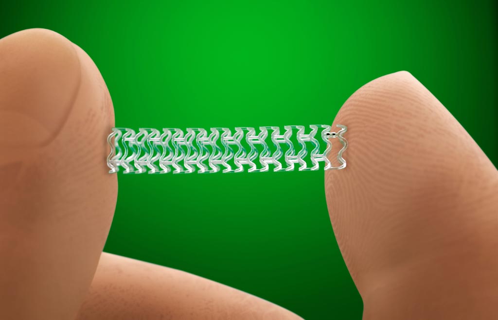 Image: The Absorb BVS, the stent used in the study (Photo courtesy of Abbott Vascular).