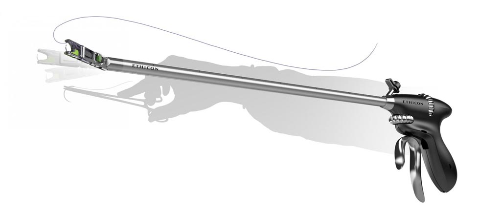 Image: The ProxiSure suturing device aids laparoscopic suturing (Photo courtesy of Ethicon).
