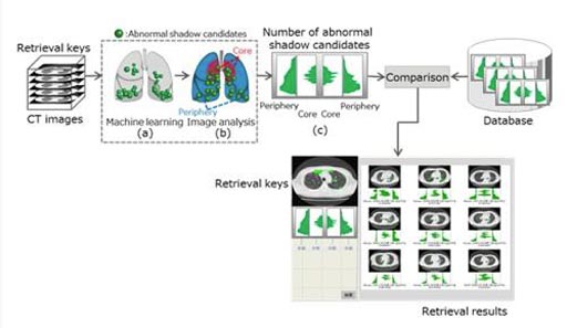 Image: Newly developed technology is designed to retrieve similar cases (Photo courtesy of Fujitsu).