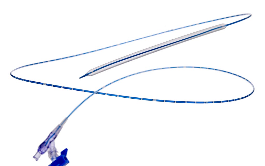 An innovative drug coated balloon (DCB) catheter helps clear the stenotic lesions that form in dialysis arteriovenous (AV) fistulae placed in end stage renal disease (ESRD) dialysis patients.