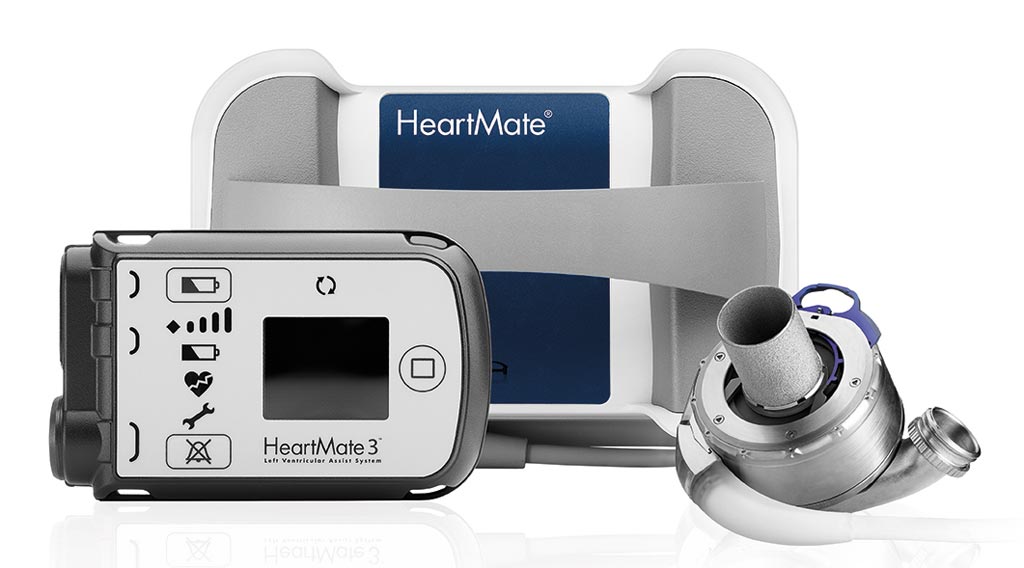 Image: The full MagLev HeartMate 3 LVAD system (Photo courtesy of Abbott).