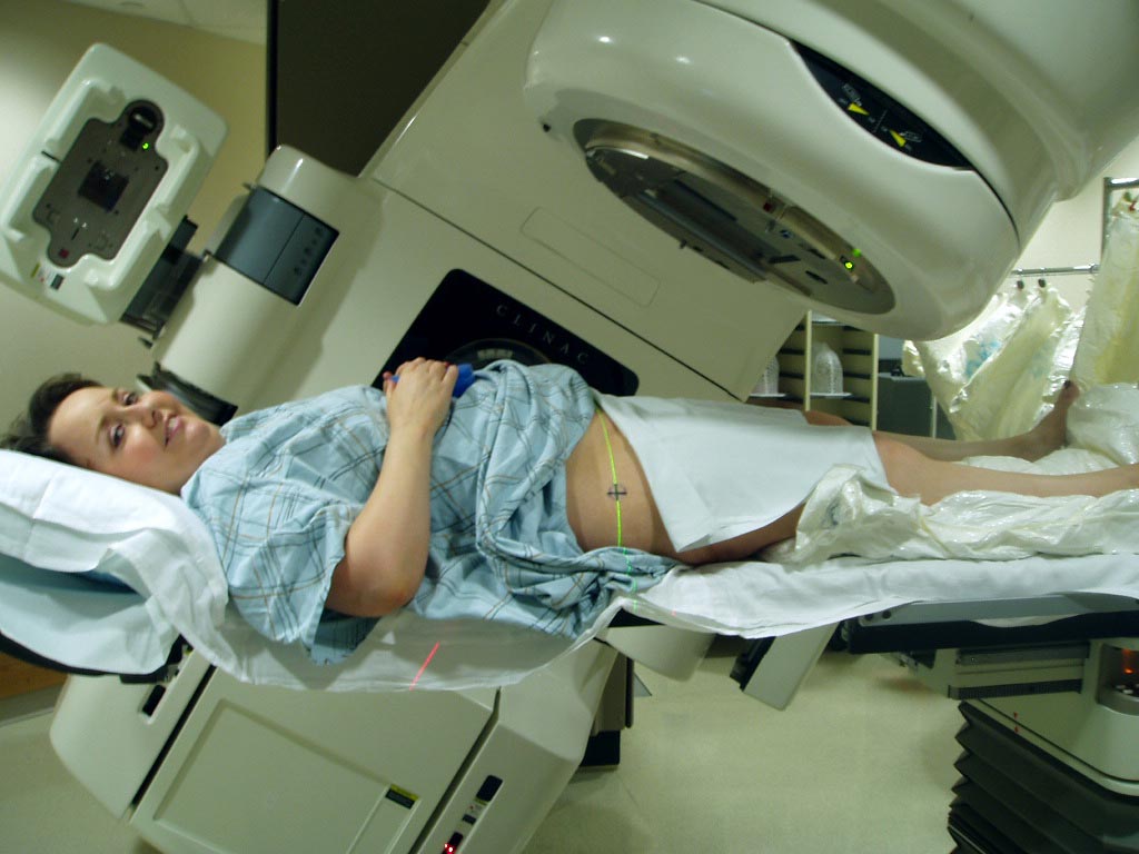Image: A new study confirms pelvic external beam therapy is preferred for treating endometrial cancer (Photo courtesy of Wikimedia). Image: A new study confirms pelvic external beam therapy is preferred for treating endometrial cancer (Photo courtesy of Wikimedia).