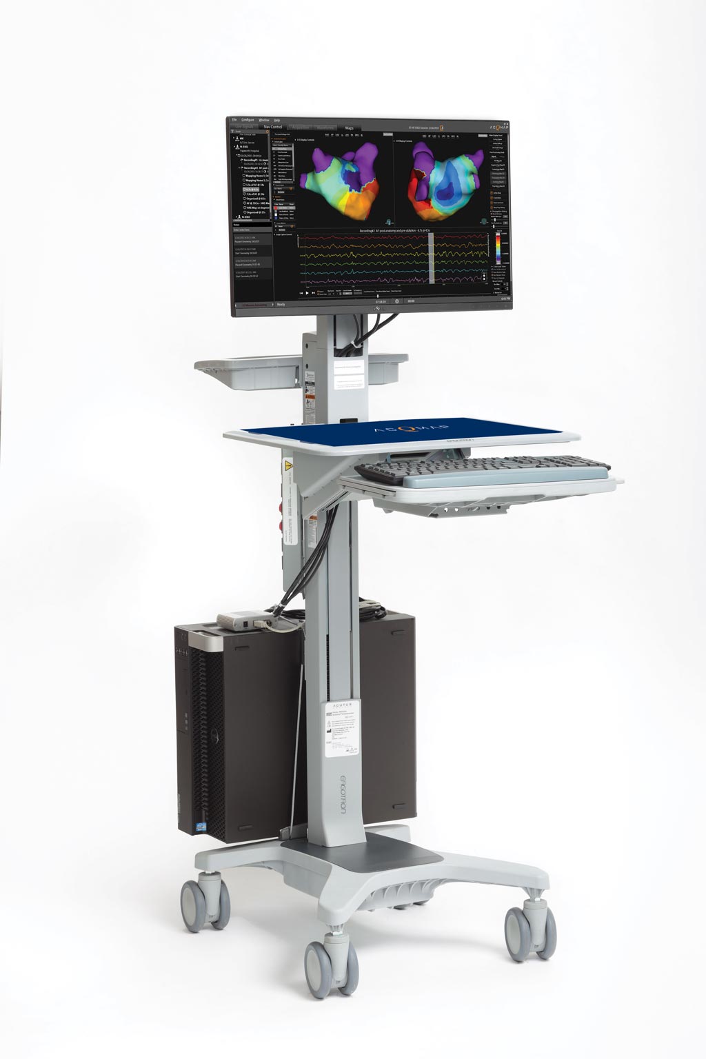 Image: The AcQMap high-resolution imaging and mapping system workstation (Photo courtesy of Acutus Medical). Image: The AcQMap high-resolution imaging and mapping system workstation (Photo courtesy of Acutus Medical).