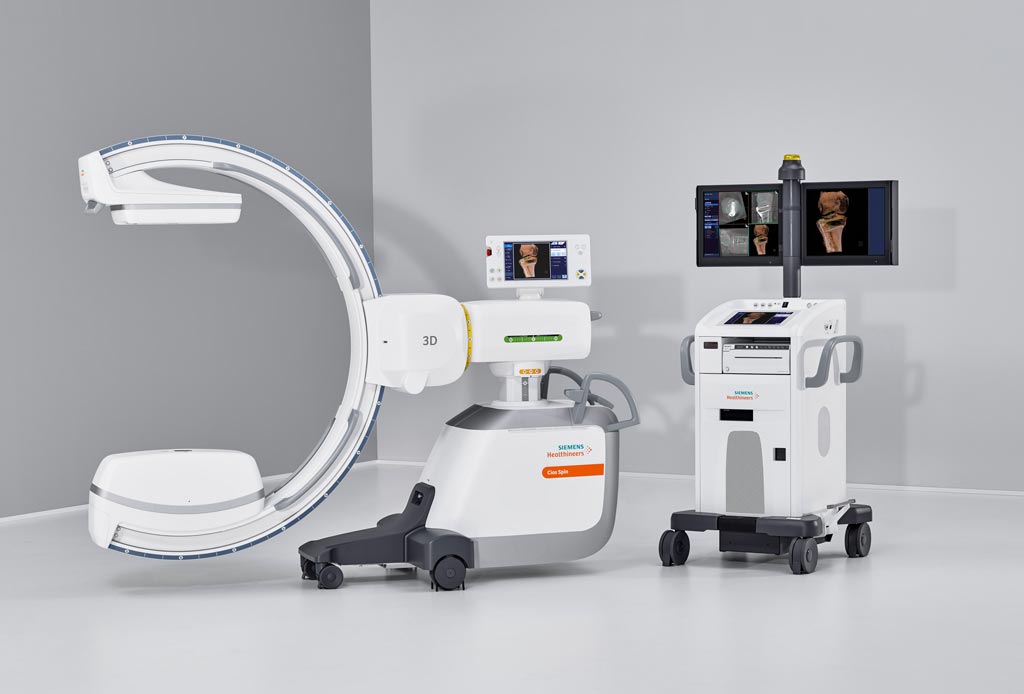 Image: The Cios Spin mobile flat detector C-arm (Photo courtesy of Siemens Healthineers). Image: The Cios Spin mobile flat detector C-arm (Photo courtesy of Siemens Healthineers).