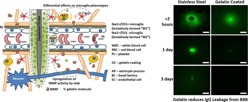 Image: A new study has shown gelatin helps wounds to the blood brain barrier resolve quicker (Photo courtesy of Lund University).