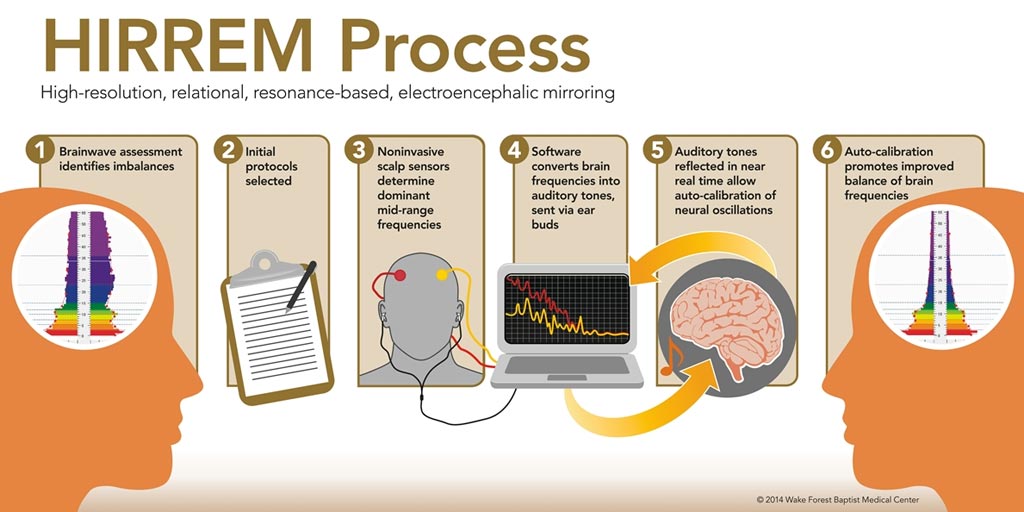 Image: The HIRREM brain autoregulation process (Photo courtesy of Wake Health).