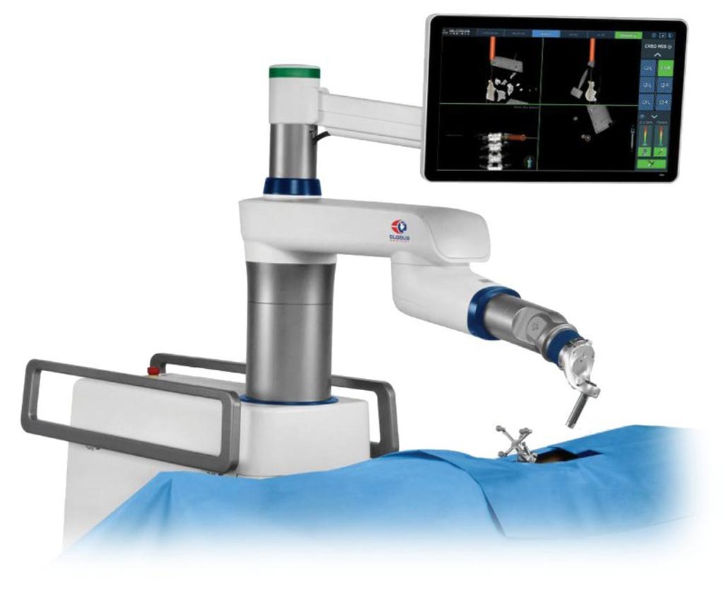 Image: The ExcelsiusGPS robotic navigation platform (Photo courtesy of Globus Medical).