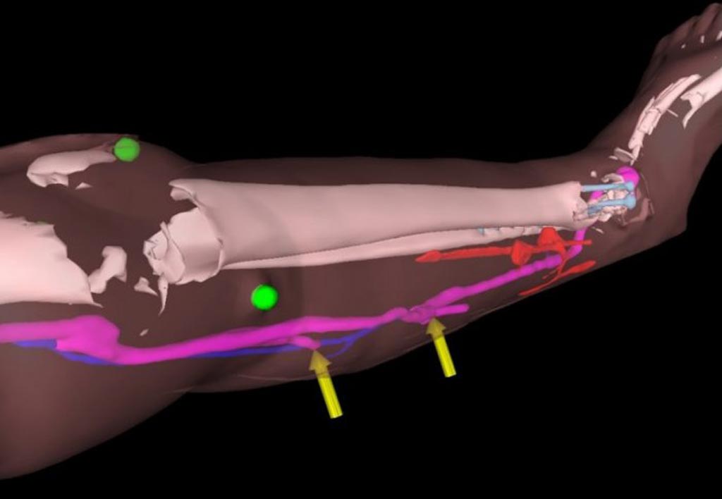 Image: The HoloLens headset helped surgeons perform reconstructive lower limb surgery on patients (Photo courtesy of Imperial College London).