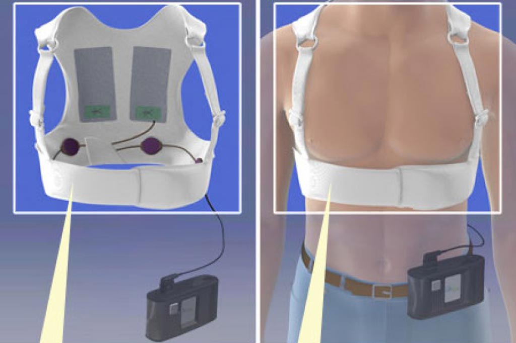 Image: The LifeVest WCD (Photo courtesy of Zoll Medical).