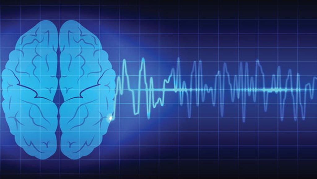 Image: A new study suggests measuring brain wave frequency can indicate pain predilection (Photo courtesy of 123rf).