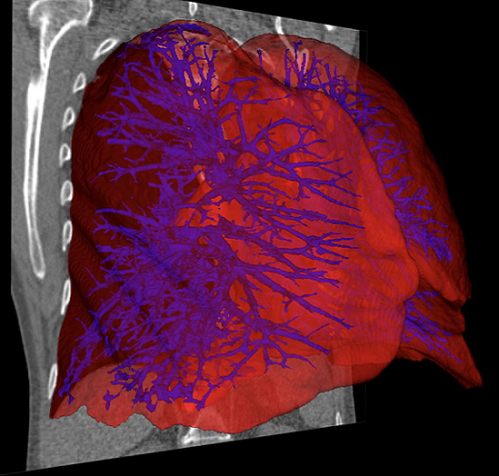 Image: The Aether 1 software uses adaptable deep learning models and an array of AI and image-processing techniques (Photo courtesy of Aether).