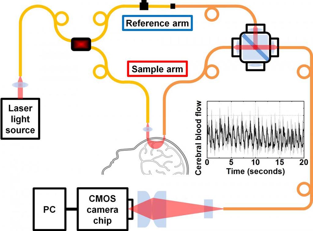 Image: Laser light can measure blood flow in the brain of patients with stroke or traumatic brain injury (Photo courtesy of Srinivasan Lab/ UCD). Image: Laser light can measure blood flow in the brain of patients with stroke or traumatic brain injury (Photo courtesy of Srinivasan Lab/ UCD).
