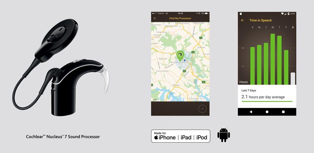 Image: Cochlear implant recipients can now control their hearing with the Nucleus Smart App (Photo courtesy of Cochlear).