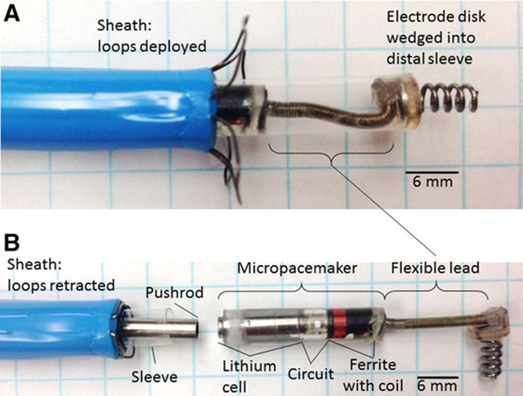 Image: An exploded view of the epicardial micropacemaker system (Photo courtesy of CHLA).