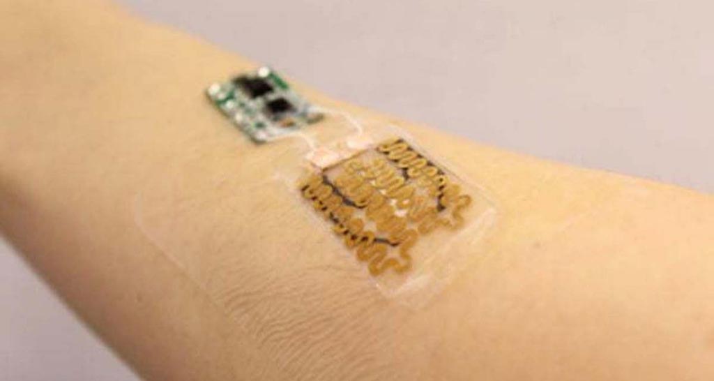 Image: A novel prototype dressing monitors wounds in real time (Photo courtesy of Sameer Sonkusale/ Tufts University).