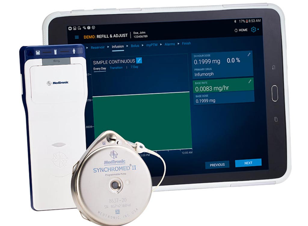 Image: The ISR system administers Remodulin for up to seven years (Photo courtesy of Medtronic).